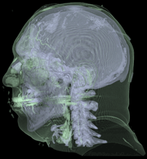 Visible Male - Saliency-guided