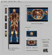 Novel overview techniques for rapid exploration of anatomical images (1995)