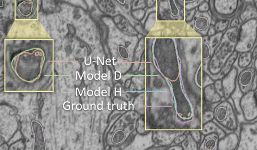 Volume Segmentation Using Convolutional Neural Networks With Limited Training Data