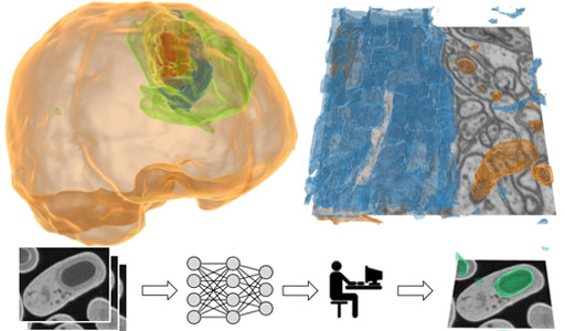 Deep-learning-assisted Volume Visualization