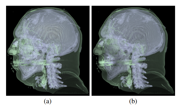 Saliency-guided Enhancement for Volume Visualization