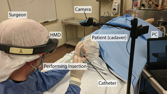 High-Precision 5DoF Tracking and Visualization of Catheter Placement in EVD of the Brain Using AR