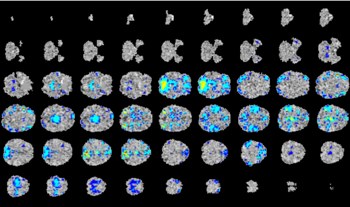 fMRI slices used as model input