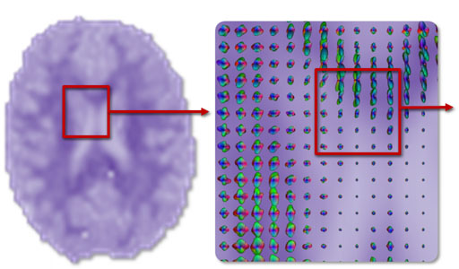 Visual Knowledge Discovery for Diffusion Kurtosis Datasets of the Human Brain